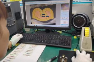 فحص المقاطع العرضية لتسخير الأسلاك المخصص للعقص الطرفي أثناء العملية